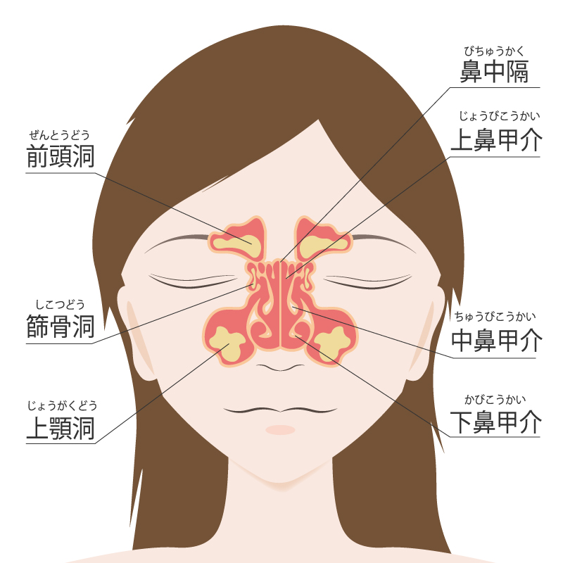 ④蓄膿症をはるかに超えた存在